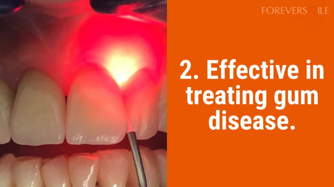 5 Benefits Of Laser Dentistry