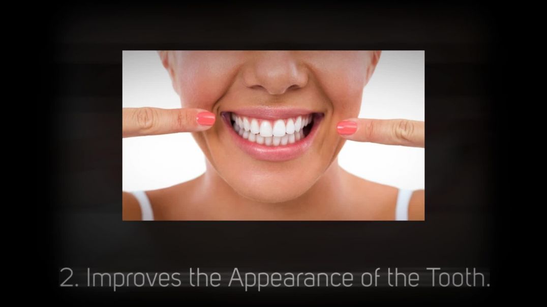 5 Facts About Root Canal Treatment
