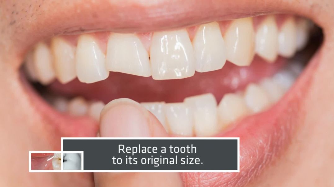 Protect the Integrity of Your Tooth