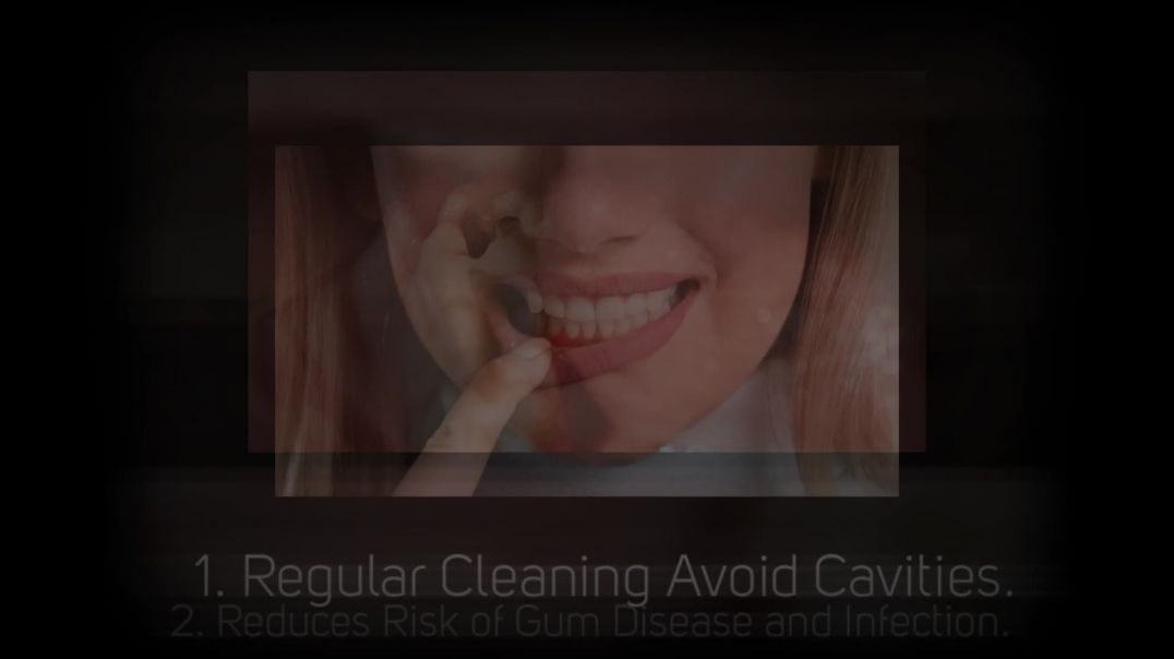 5 Facts Why Dental Cleaning is Important