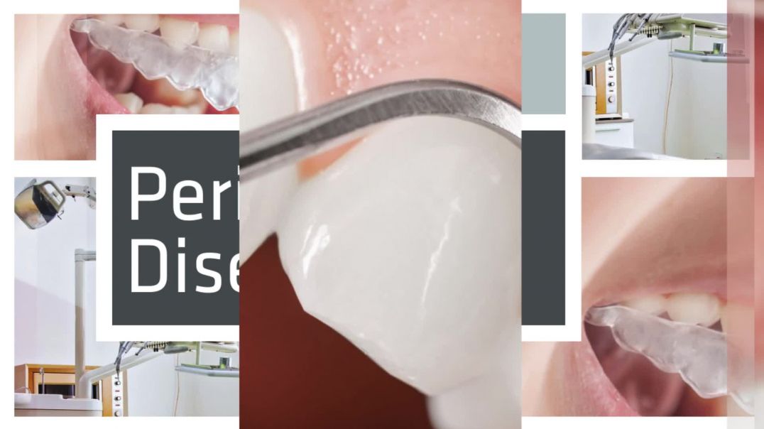 Dental Care for a Long-Lasting Smile