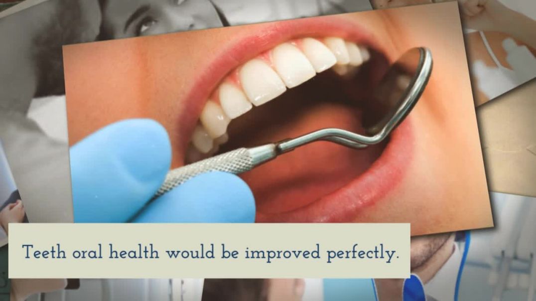 Improve the Appearance of the Mouth