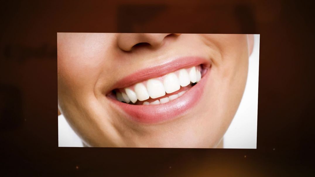 Professional to Remove External Staining