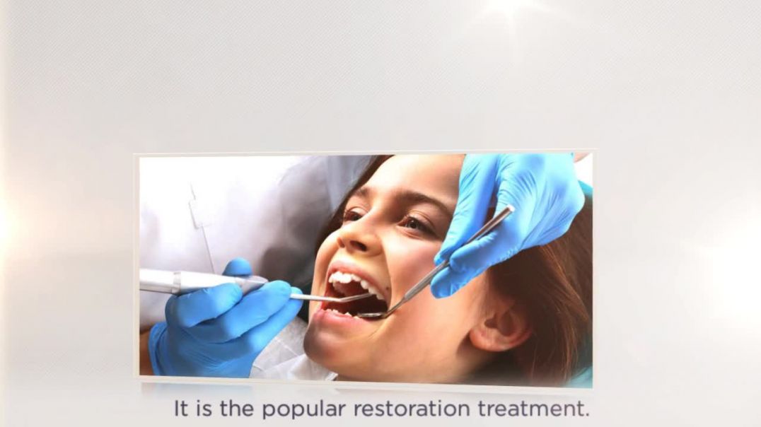 Replace the Missing Teeth by Dental Bridges