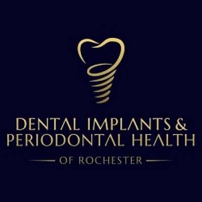 DENTAL IMPLANTS & PERIODONTAL HEALTH