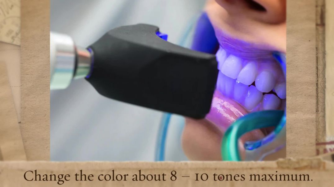 Professional Dazzling Whiter Teeth