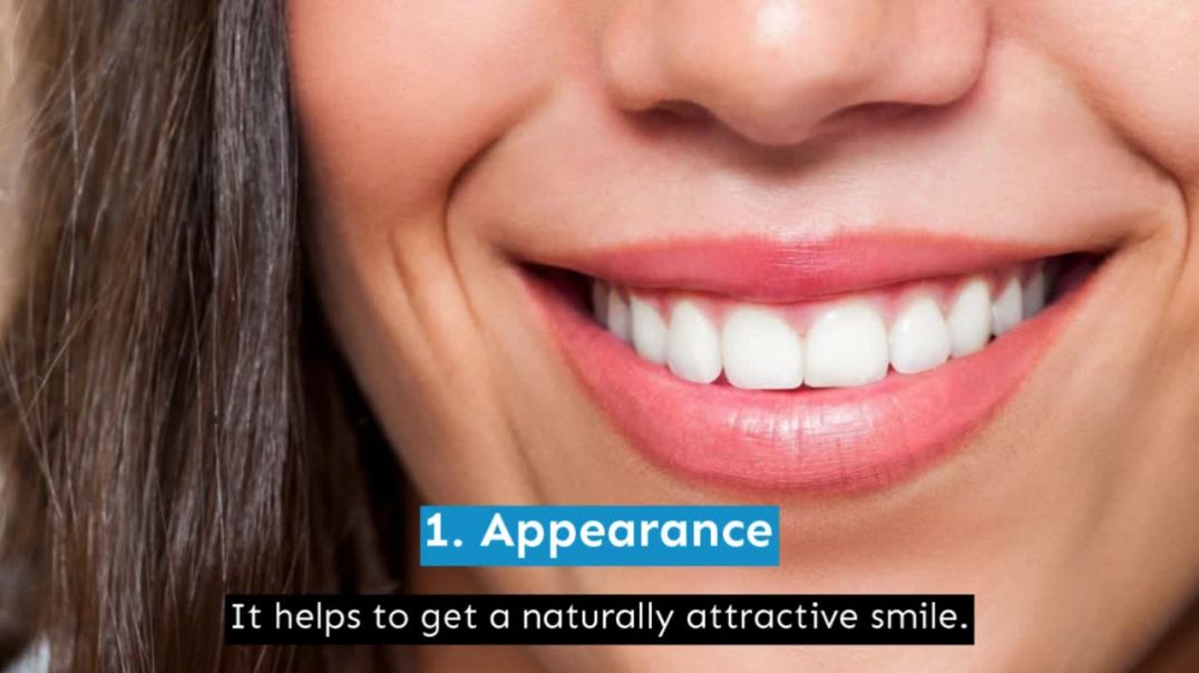 Characteristics Of Dental Implants