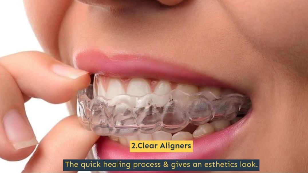 Confident Face with Orthodontic Braces