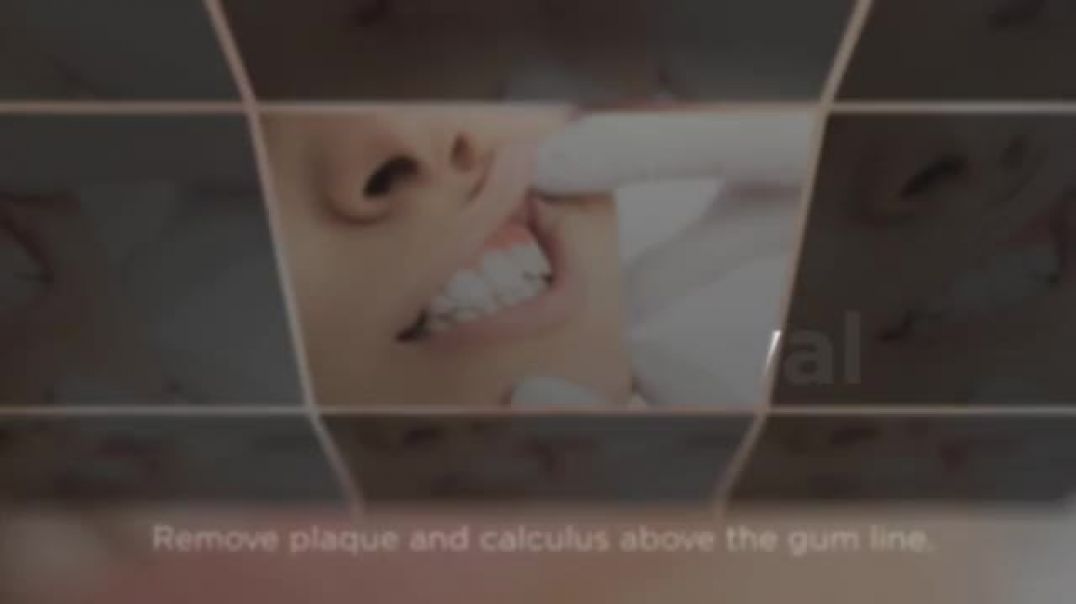 Comprehending Periodontal Maintenance Moves