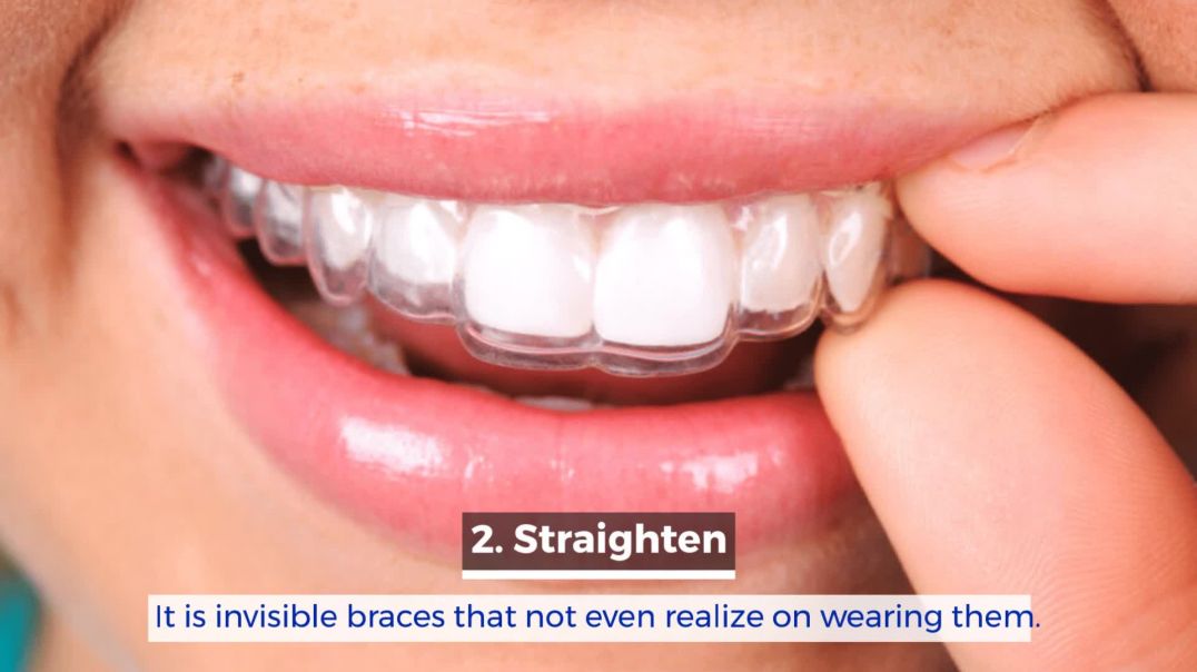 Increased Confidence With Straighter Teeth