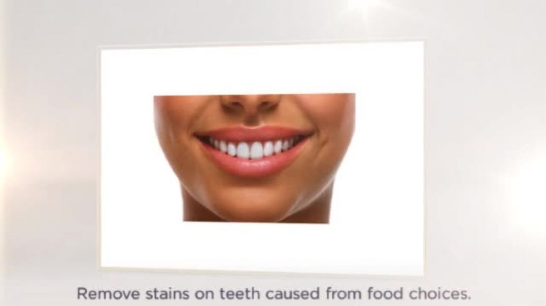 Top Reasons to your Teeth Professional Bleached