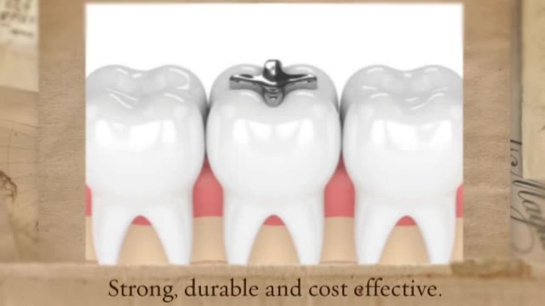 Advanced Method of Treatment in Dental Fillings