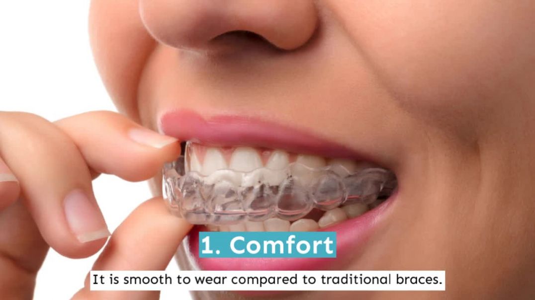 Get A Clear Smile Without Braces