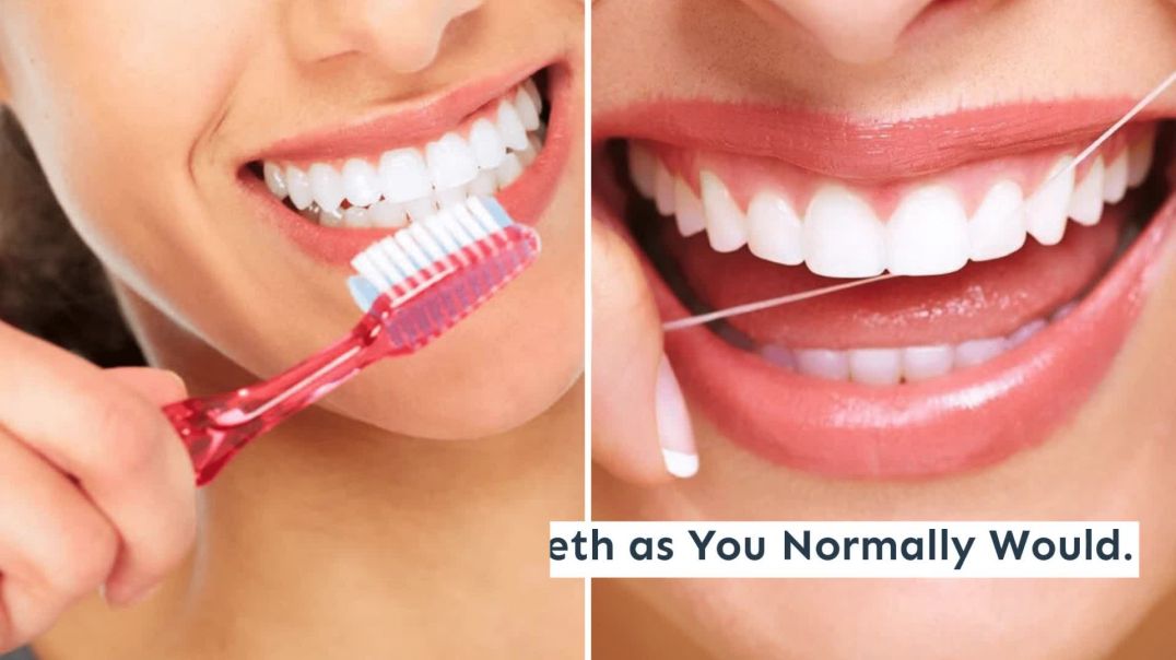 Do's and Don'ts of Root Canal Aftercare