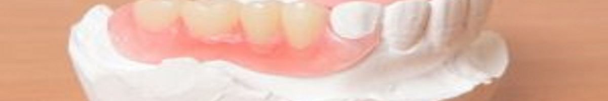 Solana Smiles - Azita Vakili, DMD | Dental Implants