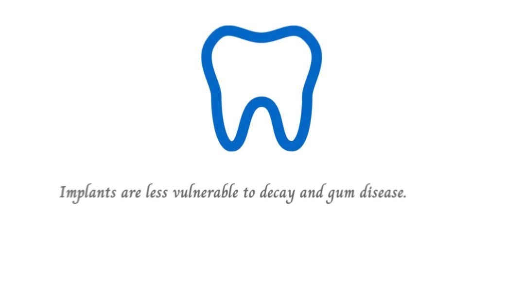 ⁣Dental Bridge vs Dental implant which should I choose | Dental Office Thornhill