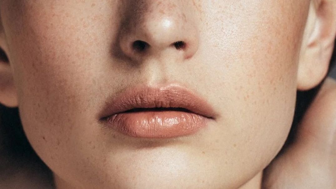 ⁣W Aesthetics : Dermal Fillers in Austin, TX