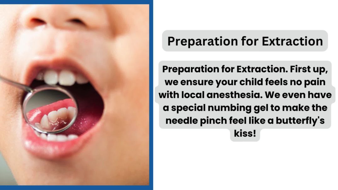 ⁣Kids Tooth Extraction Process