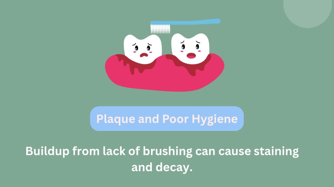 ⁣When Yellow Teeth Might Indicate a Problem
