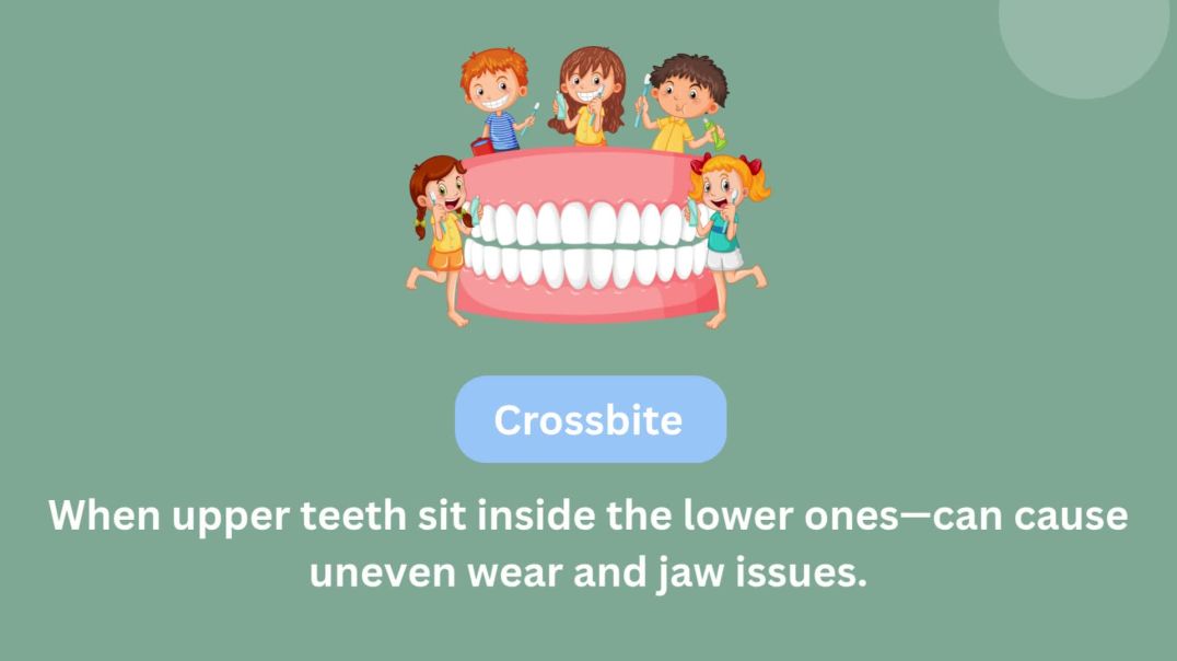 Signs of Concern – Crossbite, Underbite, Overbite