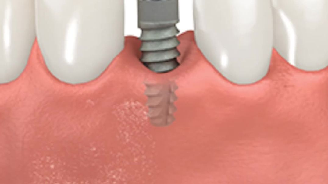 ⁣Veneto Dental Care : Cosmetic Dentist in Miramar, FL | 33025